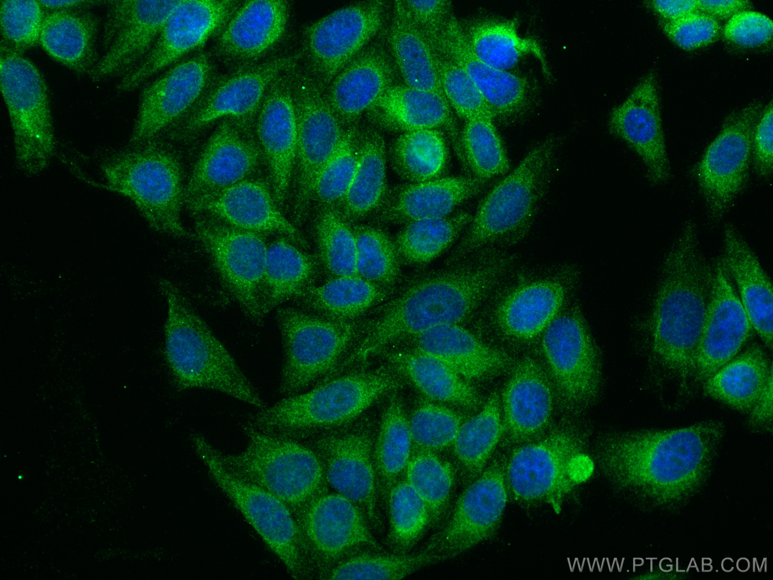 IF Staining of HepG2 using 15794-1-AP