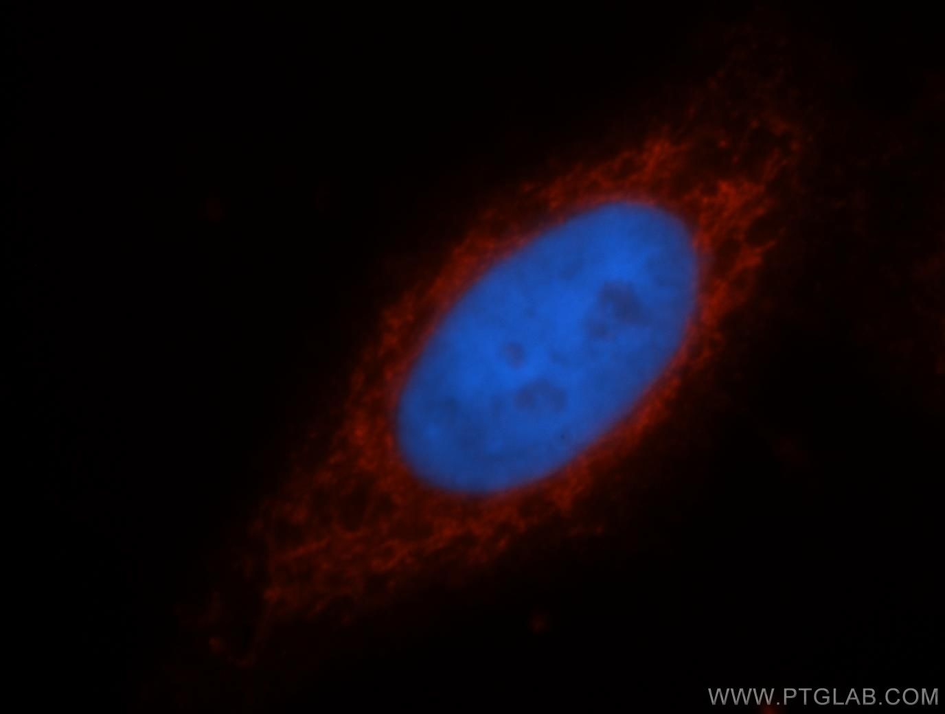 Immunofluorescence (IF) / fluorescent staining of HepG2 cells using ATF6B Polyclonal antibody (15794-1-AP)