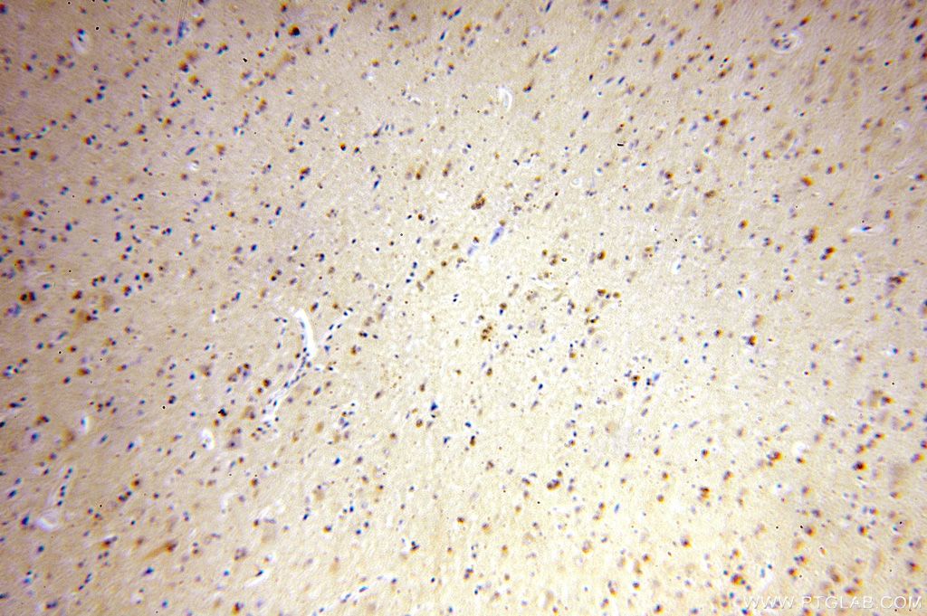 Immunohistochemistry (IHC) staining of human brain tissue using ATF6B Polyclonal antibody (15794-1-AP)