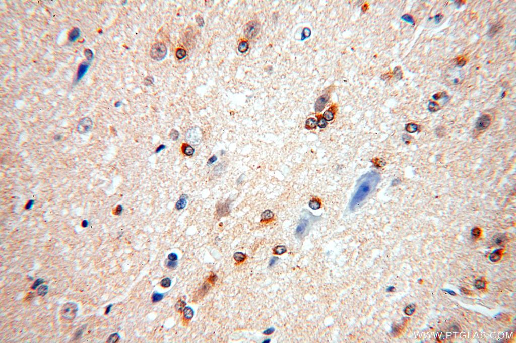 Immunohistochemistry (IHC) staining of human brain tissue using ATF6B Polyclonal antibody (15794-1-AP)