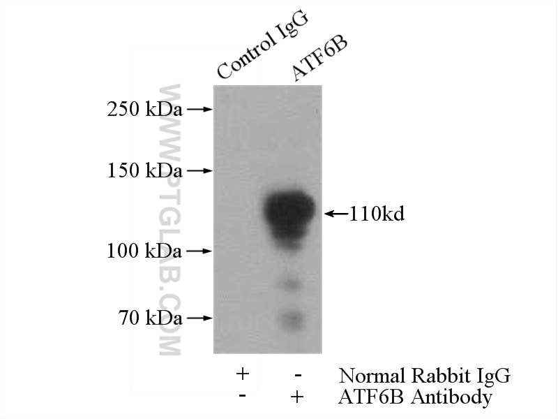 Immunoprecipitation (IP) experiment of Jurkat cells using ATF6B Polyclonal antibody (15794-1-AP)