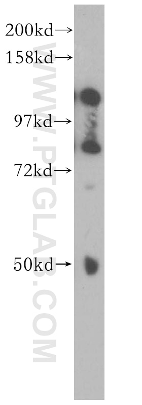 Western Blot (WB) analysis of human testis tissue using ATF6B Polyclonal antibody (15794-1-AP)