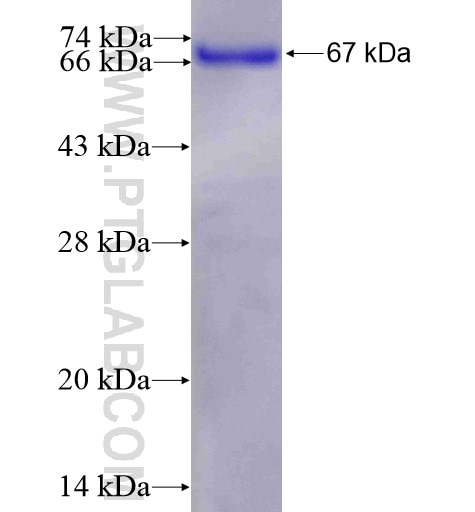 ATF7IP2 fusion protein Ag11965 SDS-PAGE