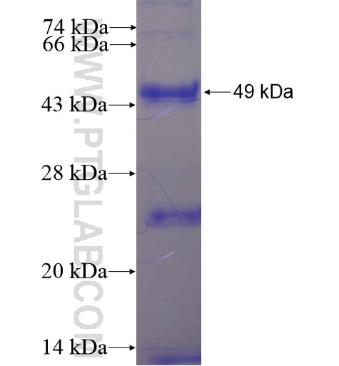 ATF7IP2 fusion protein Ag11979 SDS-PAGE