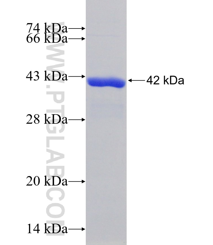 ATG10 fusion protein Ag31530 SDS-PAGE ATG10 fusion protein Ag31530 SDS-PAGE