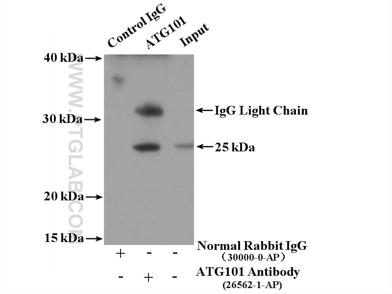 Immunoprecipitation (IP) experiment of HeLa cells using ATG101 Polyclonal antibody (26562-1-AP)