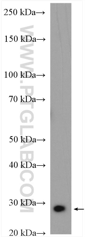 Western Blot (WB) analysis of mouse brain tissue using ATG101 Polyclonal antibody (26562-1-AP)