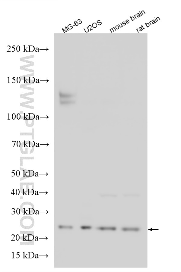 Western Blot (WB) analysis of various lysates using ATG101 Polyclonal antibody (26562-1-AP)