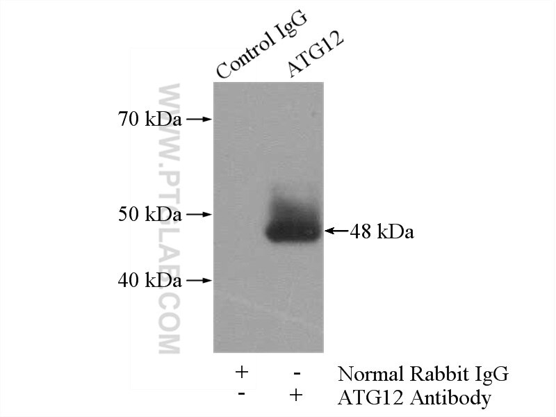 Immunoprecipitation (IP) experiment of HEK-293 cells using ATG12 Polyclonal antibody (11122-1-AP)
