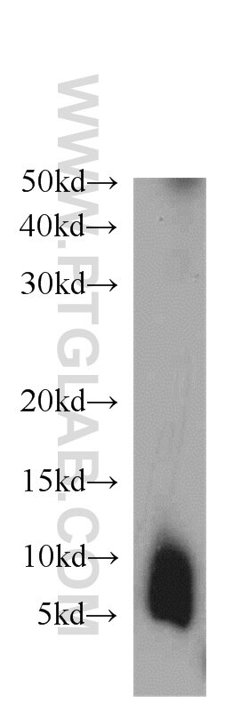 WB analysis of UV treated HEK-293 using 11122-1-AP