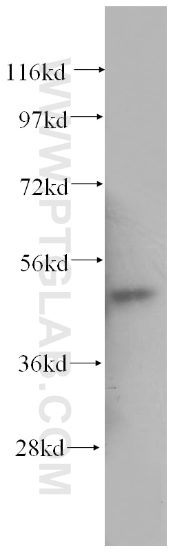 WB analysis of human bladder using 11122-1-AP