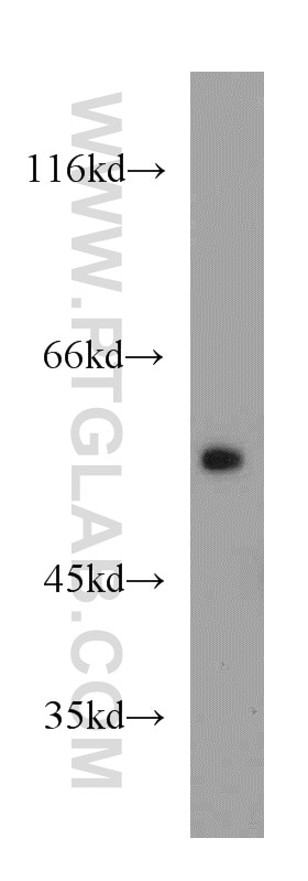 WB analysis of COLO 320 using 11264-1-AP