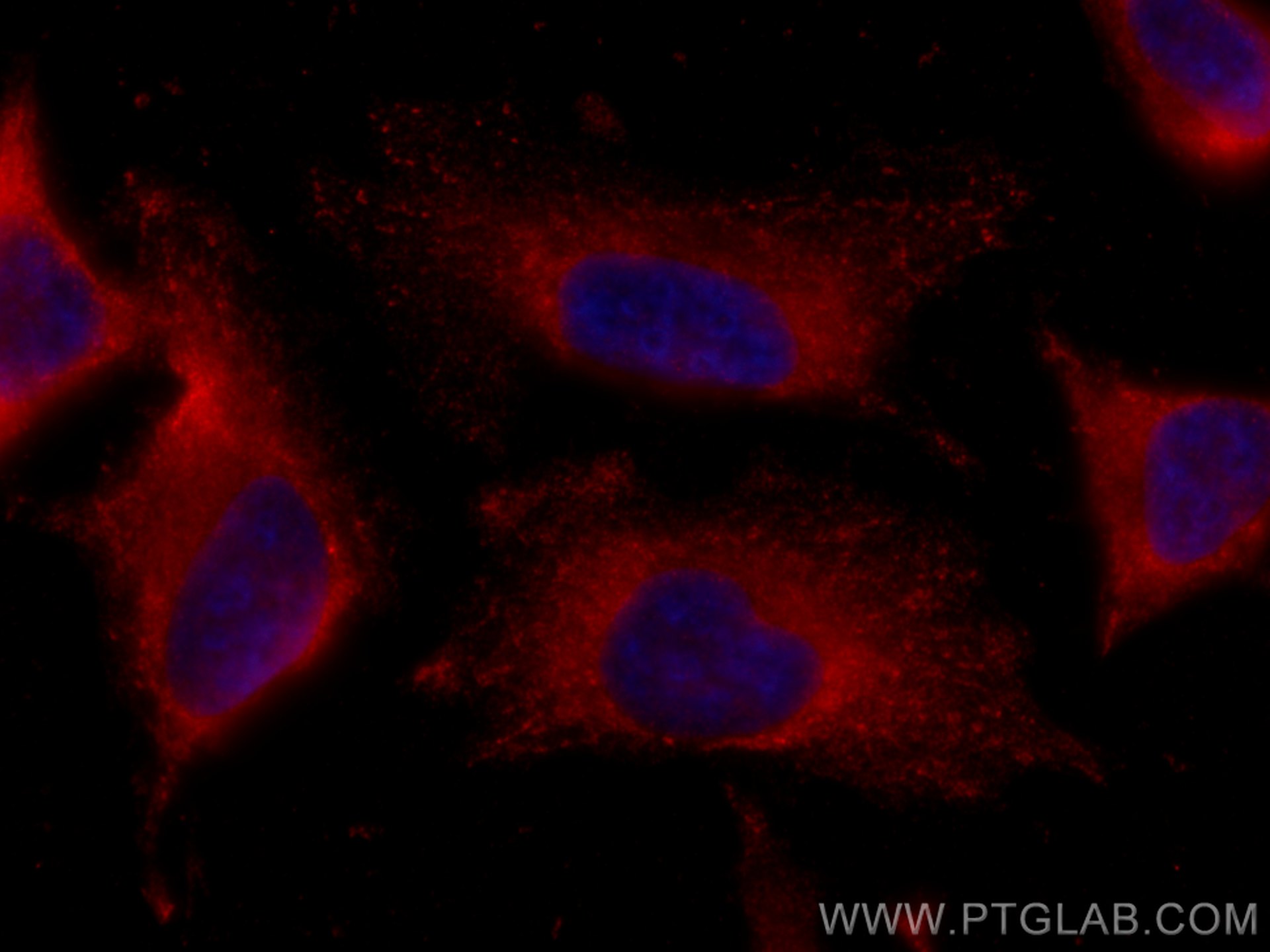 Immunofluorescence (IF) / fluorescent staining of HeLa cells using CoraLite®594-conjugated ATG13 Monoclonal antibody (CL594-66708)