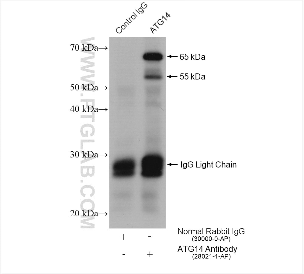 Immunoprecipitation (IP) experiment of rat brain tissue using ATG14/Barkor Polyclonal antibody (28021-1-AP)
