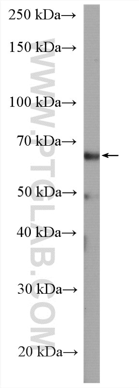 Western Blot (WB) analysis of A549 cells using ATG14/Barkor Polyclonal antibody (28021-1-AP)