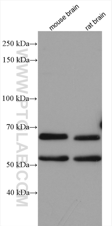 Western Blot (WB) analysis of various lysates using ATG14/Barkor Polyclonal antibody (28021-1-AP)