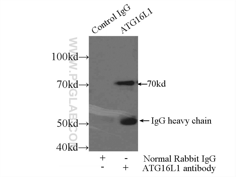 Immunoprecipitation (IP) experiment of MCF-7 cells using ATG16L1 Polyclonal antibody (19812-1-AP)