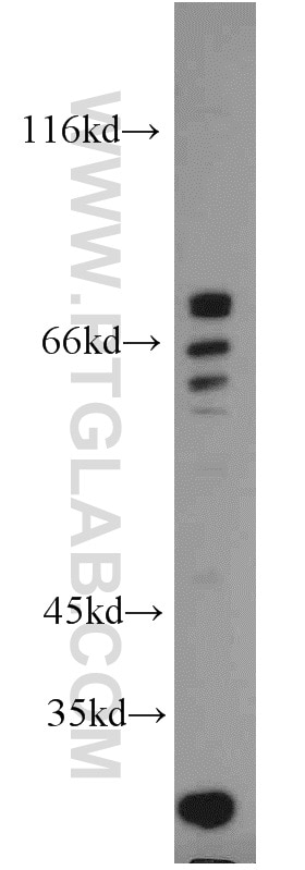 ATG16L1 Polyclonal antibody