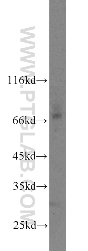 Western Blot (WB) analysis of Jurkat cells using ATG16L1 Polyclonal antibody (19812-1-AP)