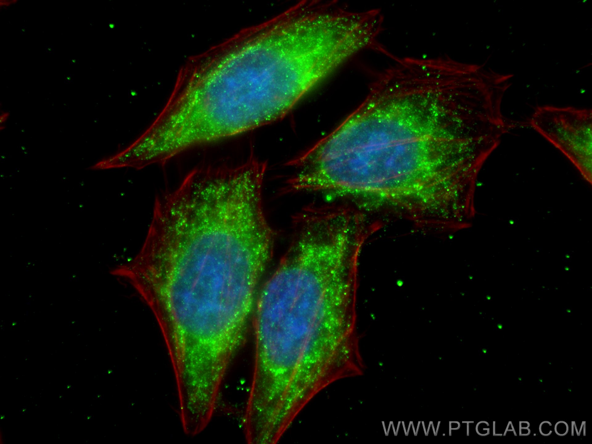 Immunofluorescence (IF) / fluorescent staining of HepG2 cells using ATG16L1 Monoclonal antibody (67943-1-Ig)