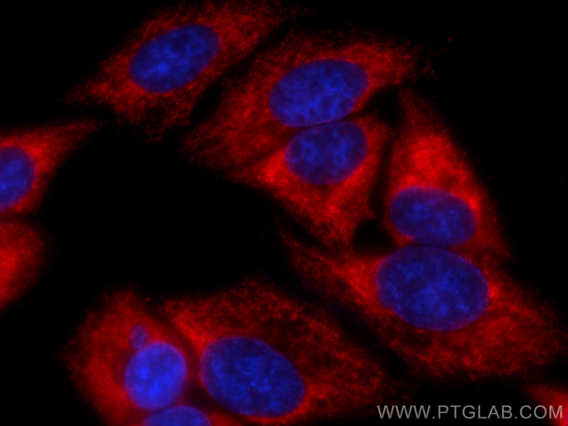 Immunofluorescence (IF) / fluorescent staining of HepG2 cells using CoraLite®594-conjugated ATG16L1 Monoclonal antibod (CL594-67943)