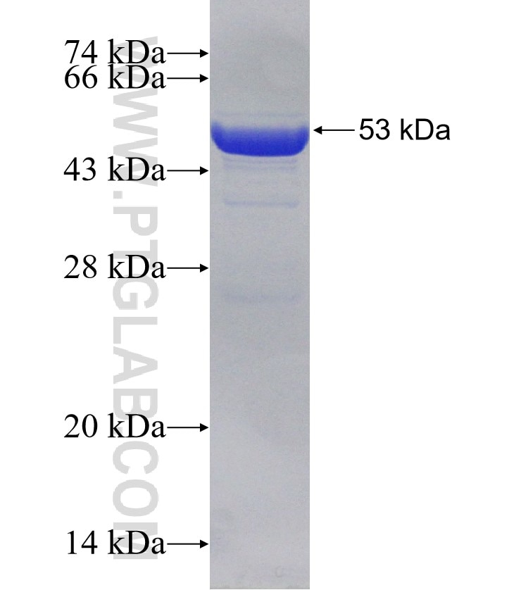 ATG16L1 fusion protein Ag31318 SDS-PAGE