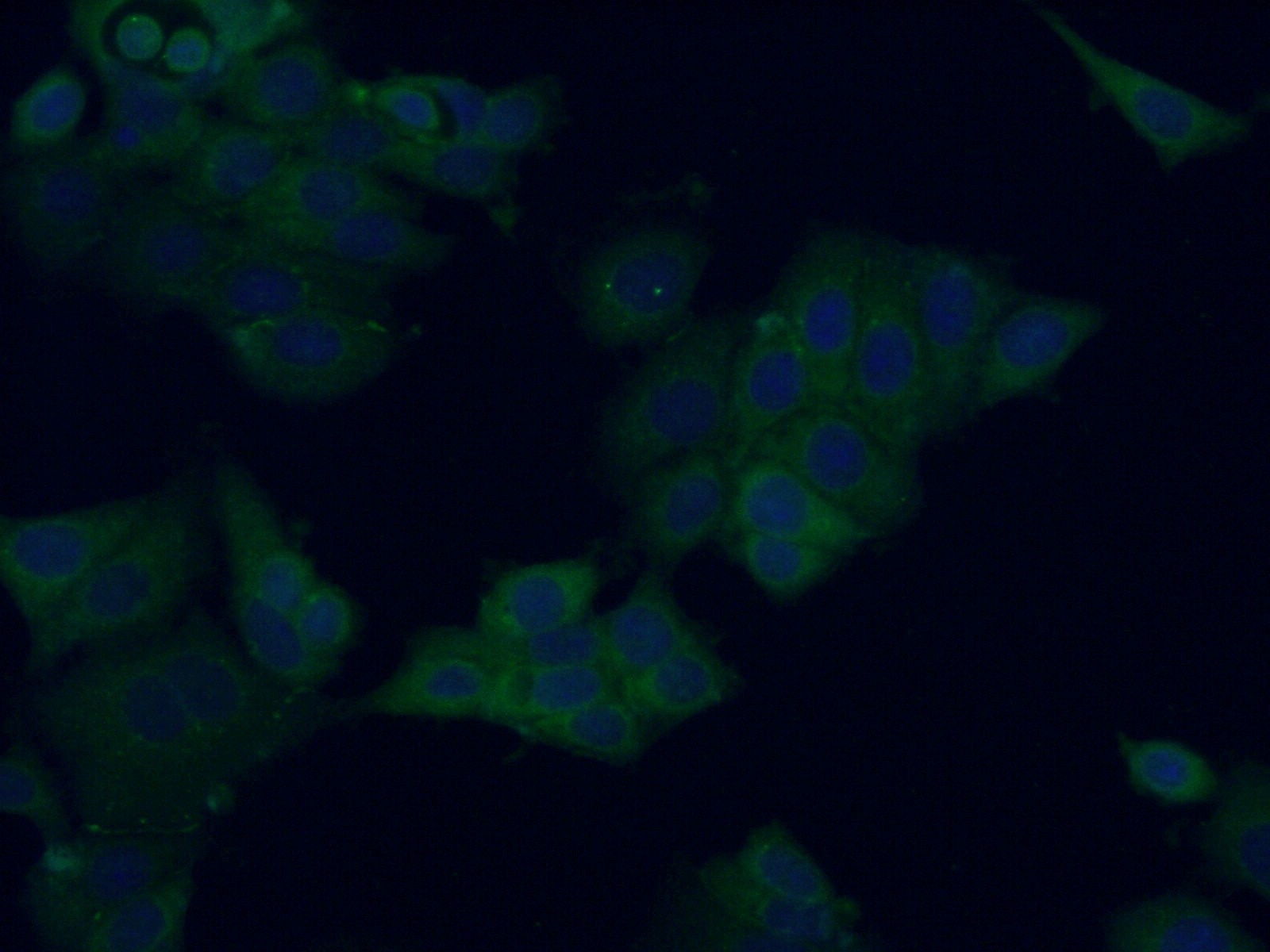 Immunofluorescence (IF) / fluorescent staining of MCF-7 cells using ATG16L2 Polyclonal antibody (24322-1-AP)