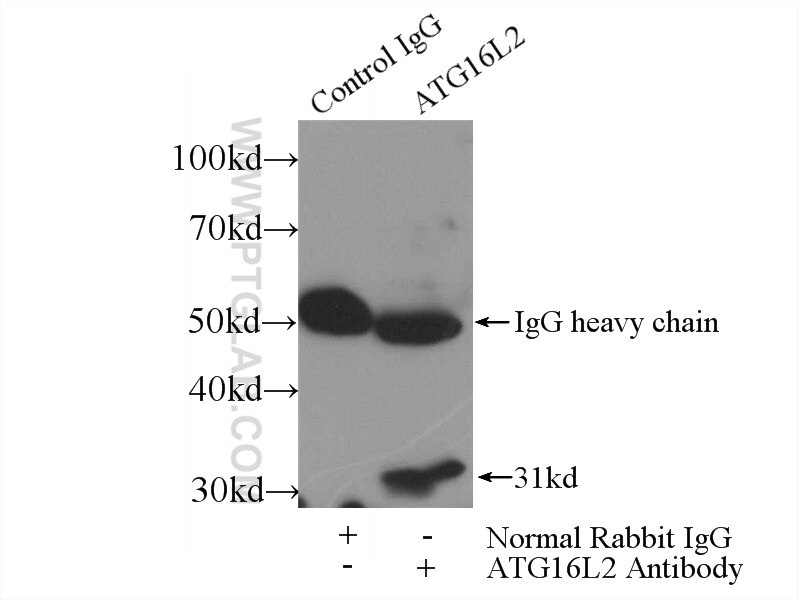 Immunoprecipitation (IP) experiment of mouse testis tissue using ATG16L2 Polyclonal antibody (24322-1-AP)