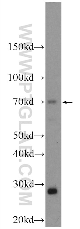 Western Blot (WB) analysis of mouse spleen tissue using ATG16L2 Polyclonal antibody (24322-1-AP)