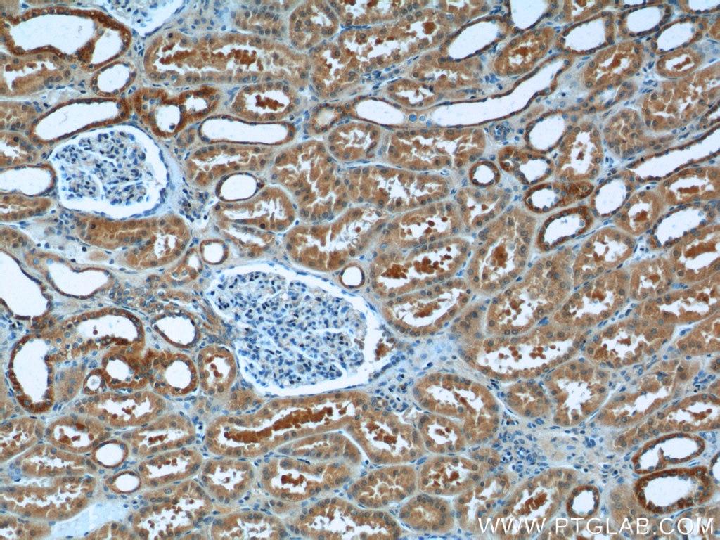 Immunohistochemistry (IHC) staining of human kidney tissue using ATG2A Polyclonal antibody (23226-1-AP)
