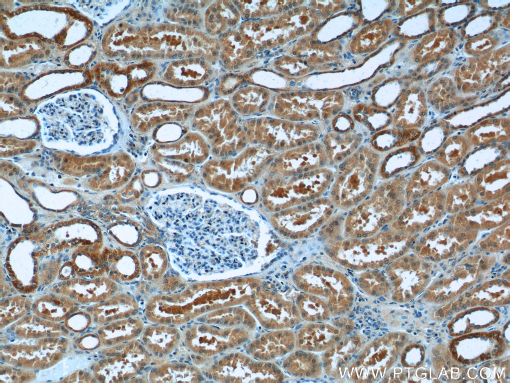 IHC staining of human kidney using 23226-1-AP