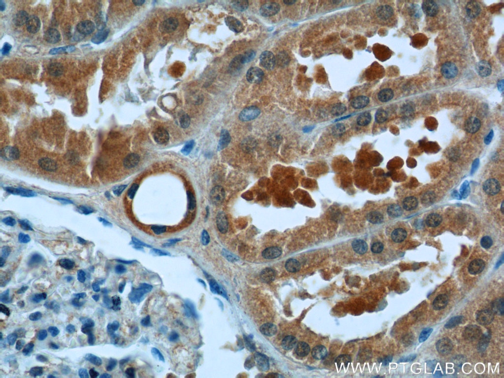 IHC staining of human kidney using 23226-1-AP