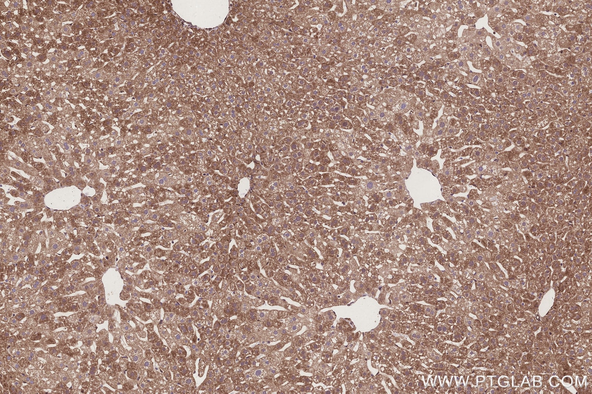 Immunohistochemistry (IHC) staining of mouse liver tissue using ATG2A Polyclonal antibody (23226-1-AP)