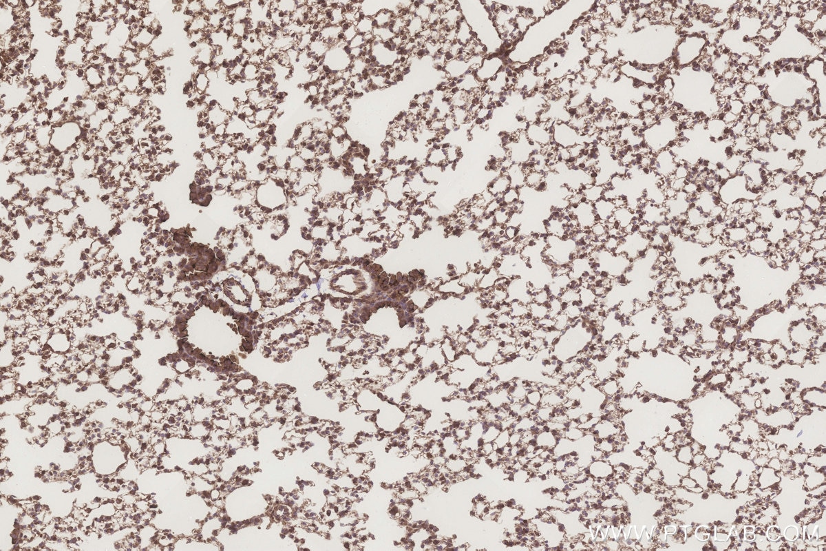 Immunohistochemistry (IHC) staining of mouse lung tissue using ATG2A Polyclonal antibody (23226-1-AP)