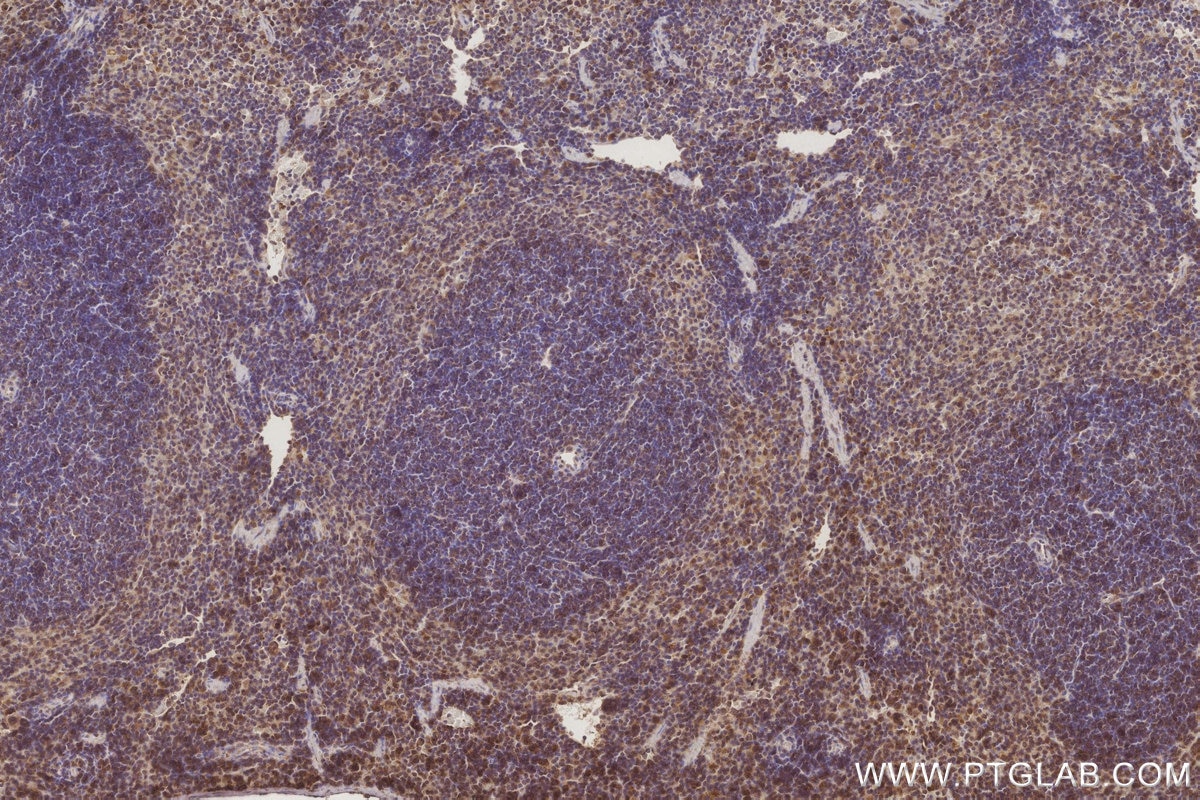 Immunohistochemistry (IHC) staining of mouse spleen tissue using ATG2A Polyclonal antibody (23226-1-AP)