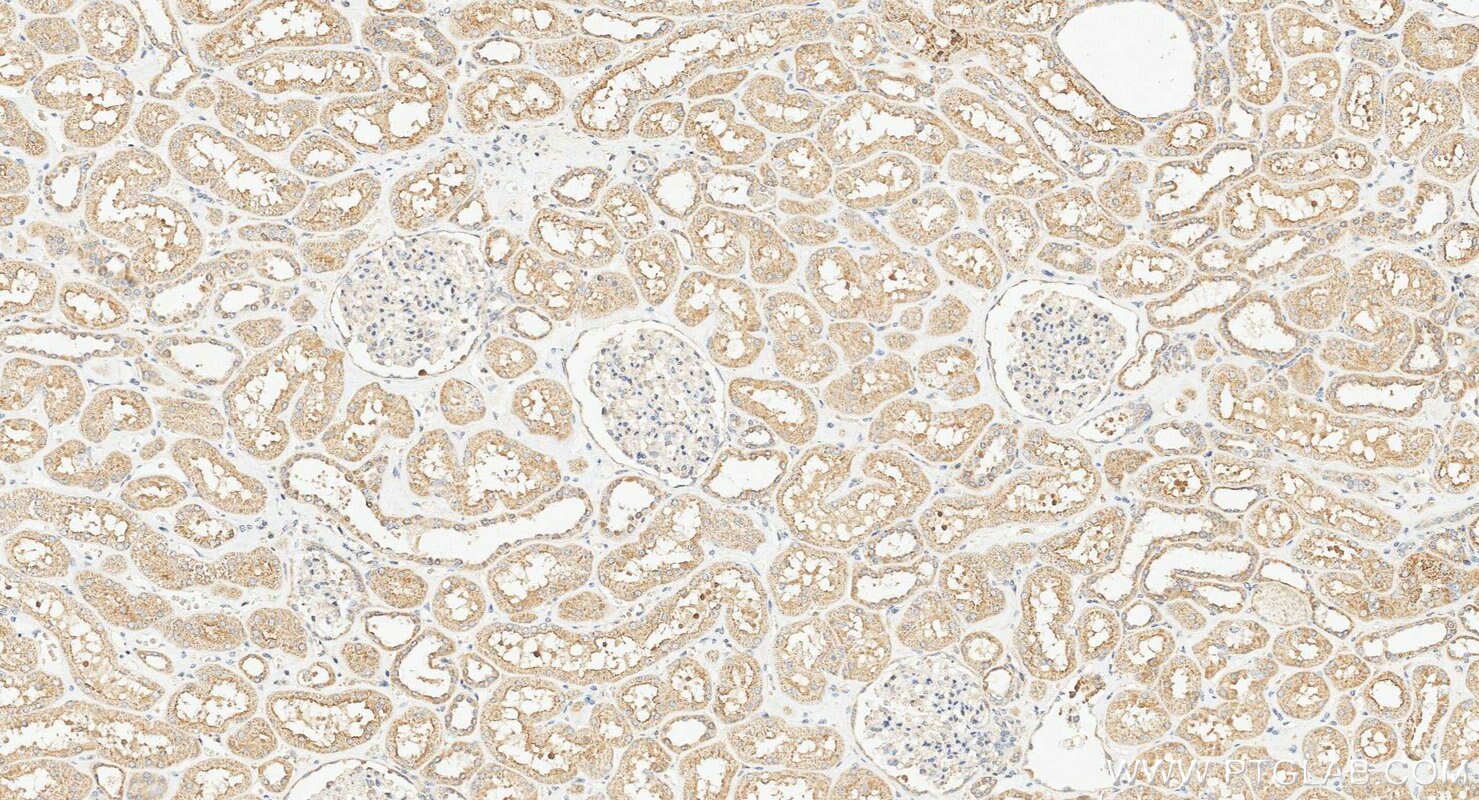 IHC staining of human kidney using 23226-1-AP Immunohistochemistry (IHC) staining of human kidney tissue using ATG2A Polyclonal antibody (23226-1-AP)