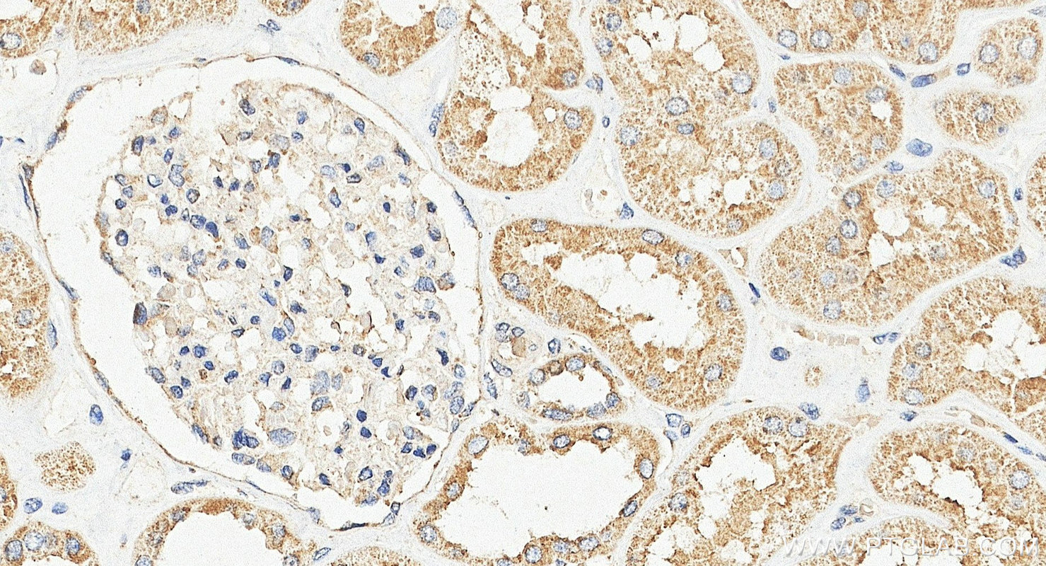 IHC staining of human kidney using 23226-1-AP Immunohistochemistry (IHC) staining of human kidney tissue using ATG2A Polyclonal antibody (23226-1-AP)