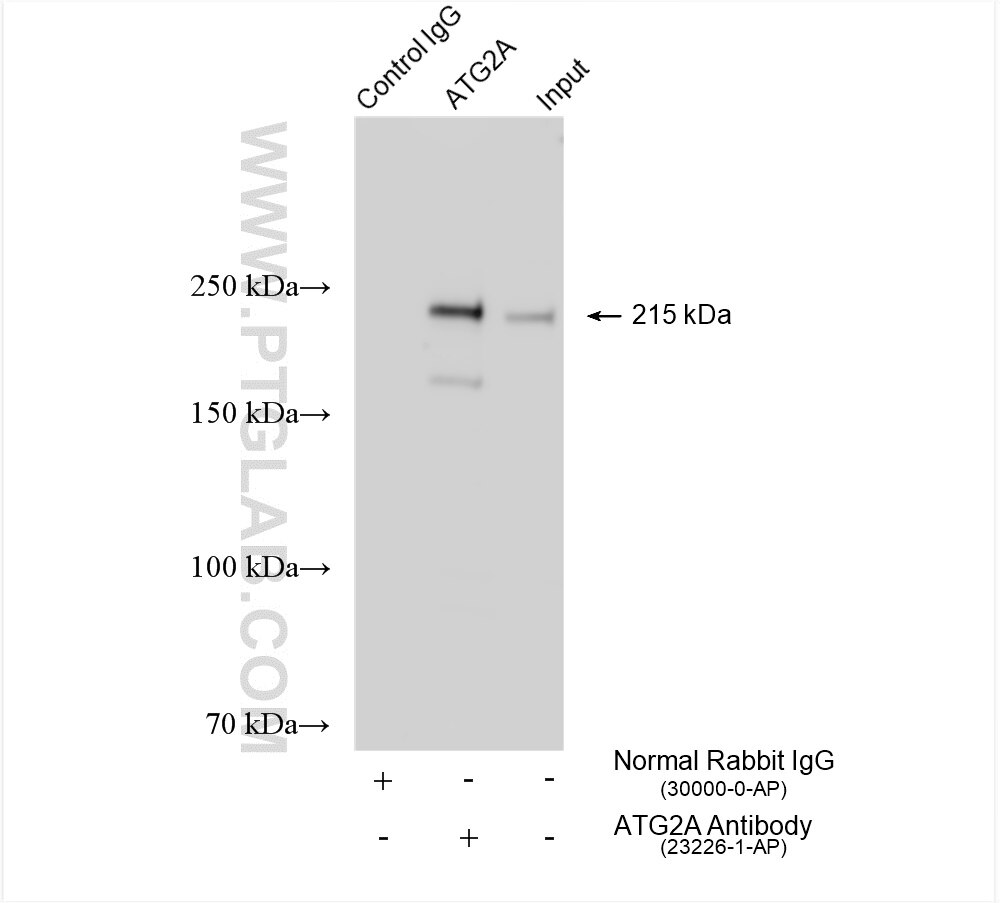 Immunoprecipitation (IP) experiment of K-562 cells using ATG2A Polyclonal antibody (23226-1-AP)
