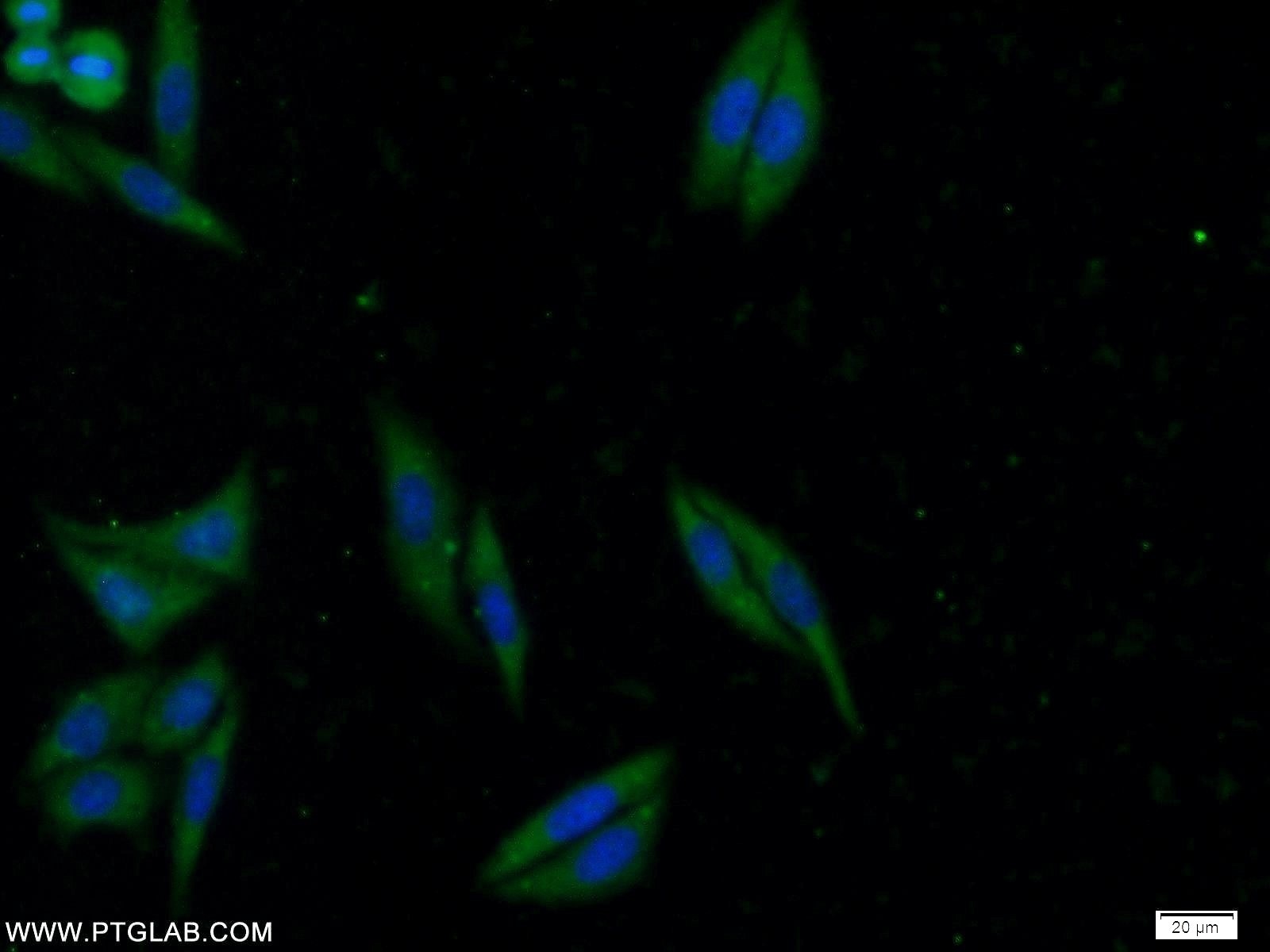 Immunofluorescence (IF) / fluorescent staining of HepG2 cells using ATG2B Polyclonal antibody (25155-1-AP)