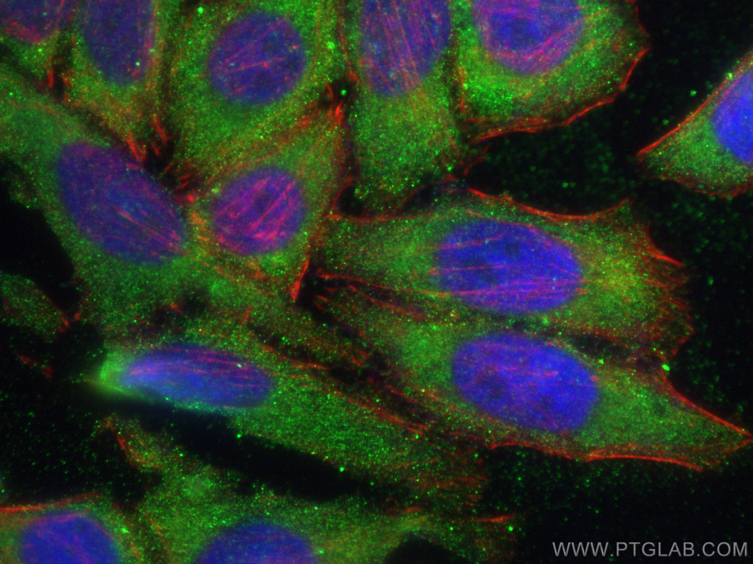 Immunofluorescence (IF) / fluorescent staining of HepG2 cells using ATG2B Polyclonal antibody (25155-1-AP)