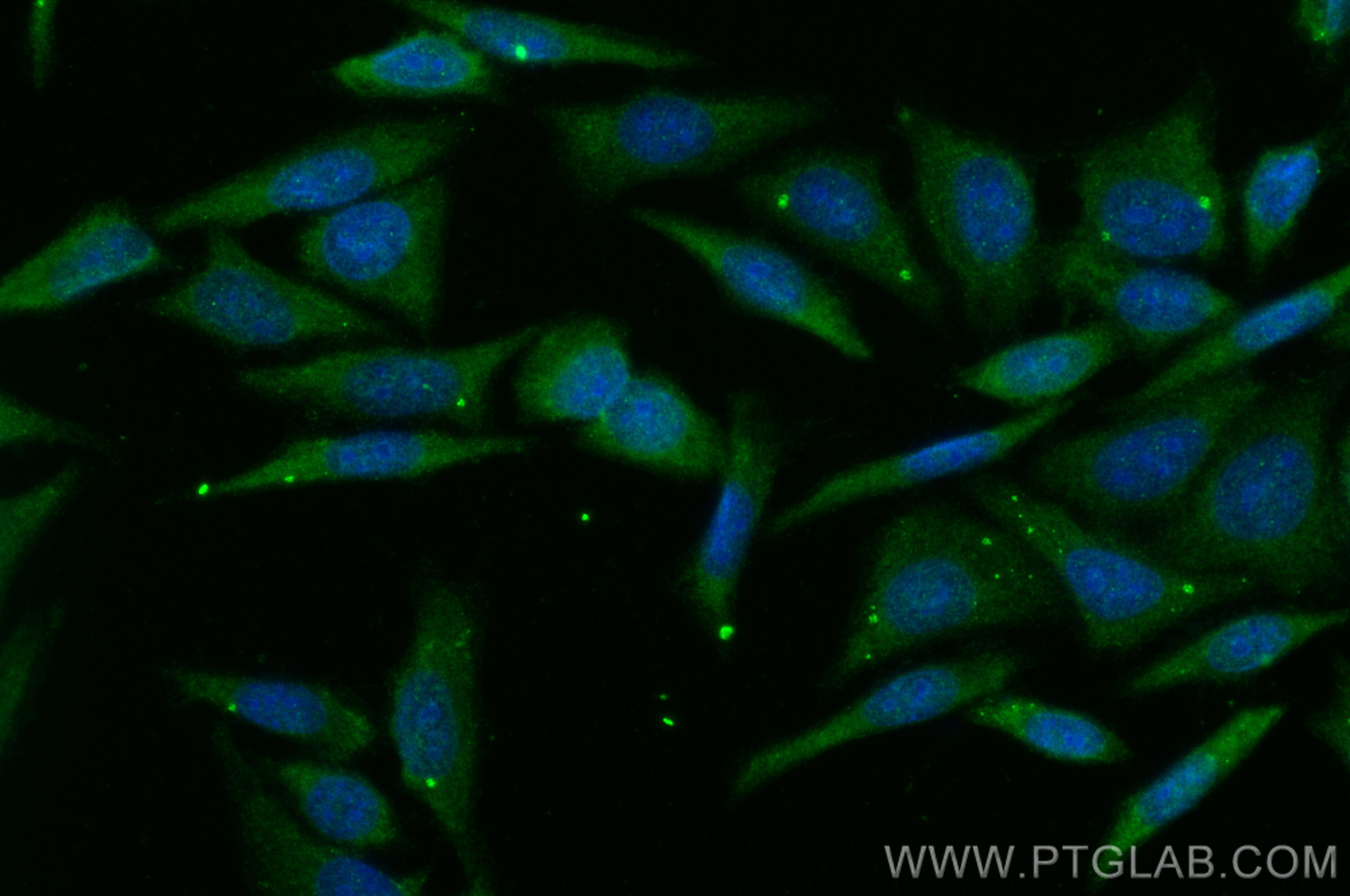 IF Staining of HepG2 using 25155-1-AP