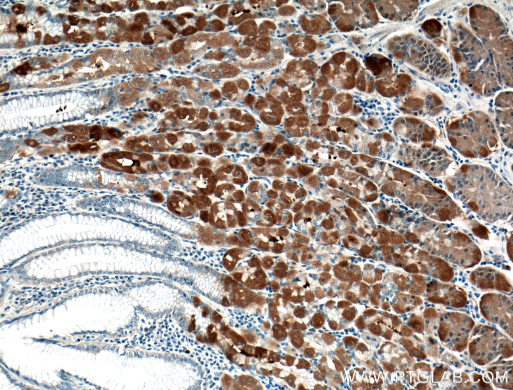 Immunohistochemistry (IHC) staining of human stomach tissue using ATG2B Polyclonal antibody (25155-1-AP)