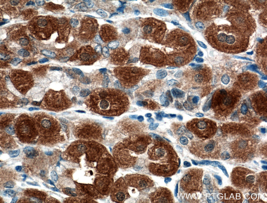 Immunohistochemistry (IHC) staining of human stomach tissue using ATG2B Polyclonal antibody (25155-1-AP)