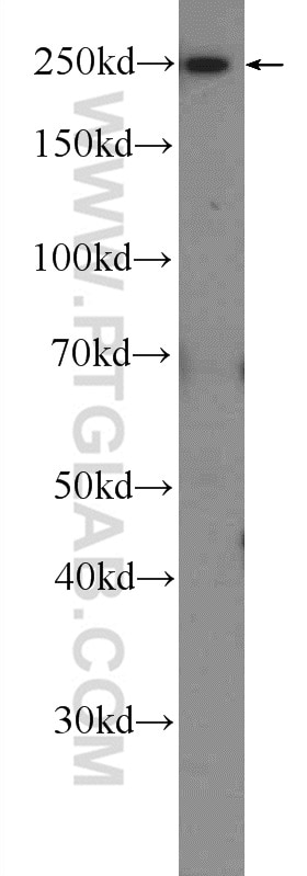 Western Blot (WB) analysis of HeLa cells using ATG2B Polyclonal antibody (25155-1-AP)