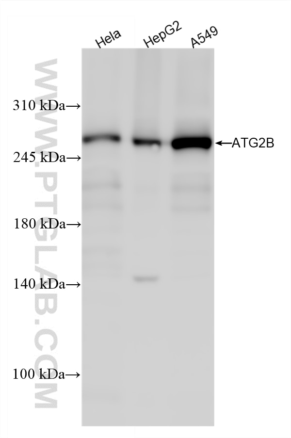 WB analysis using 25155-1-AP Western Blot (WB) analysis of various lysates using ATG2B Polyclonal antibody (25155-1-AP)