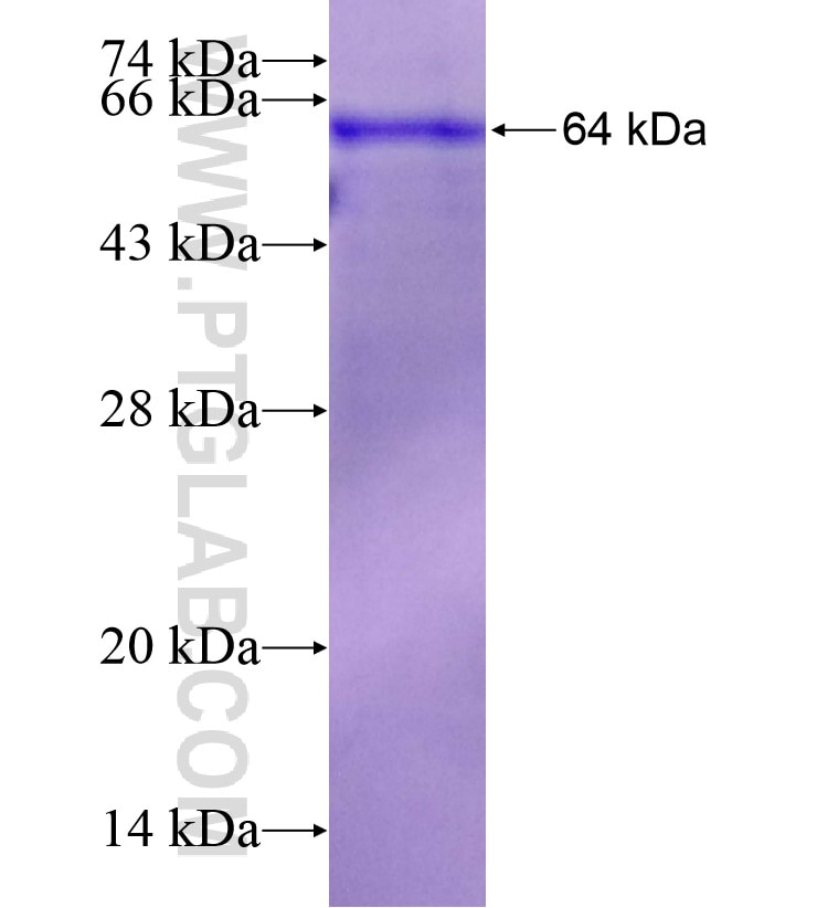 ATG2B fusion protein Ag18412 SDS-PAGE