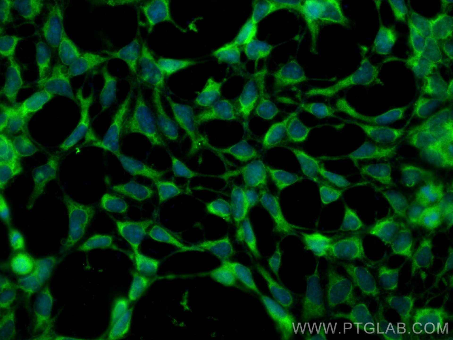 Immunofluorescence (IF) / fluorescent staining of HEK-293 cells using ATG3 Polyclonal antibody (11262-2-AP)