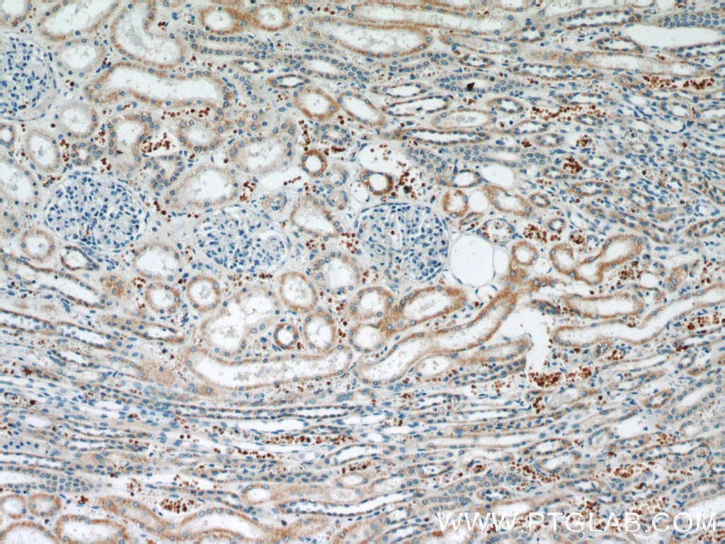 Immunohistochemistry (IHC) staining of human kidney tissue using ATG3 Polyclonal antibody (11262-2-AP)