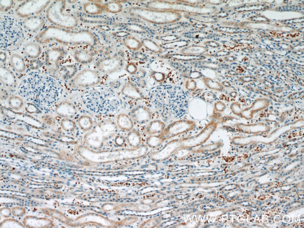 Immunohistochemistry (IHC) staining of human kidney tissue using ATG3 Polyclonal antibody (11262-2-AP)