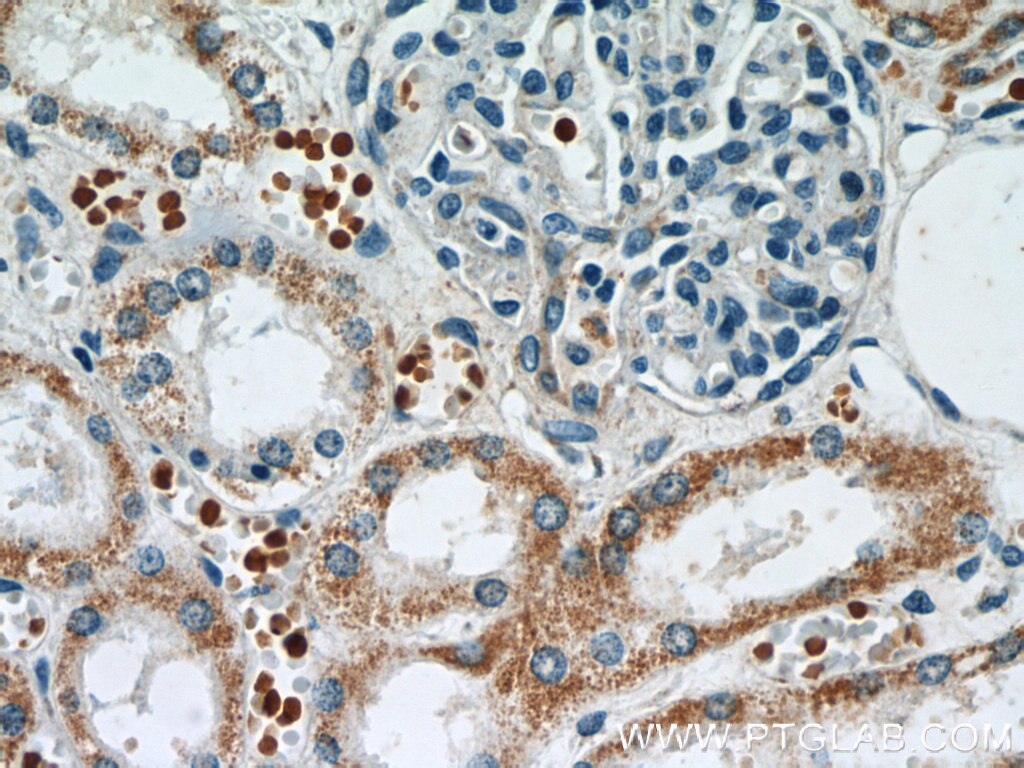 Immunohistochemistry (IHC) staining of human kidney tissue using ATG3 Polyclonal antibody (11262-2-AP)
